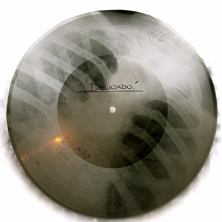 MUSIC ON RIBS: A Brief History of Soviet X-Ray Records